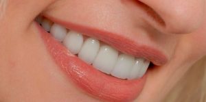 1 diş implantı kaç TL 2025?